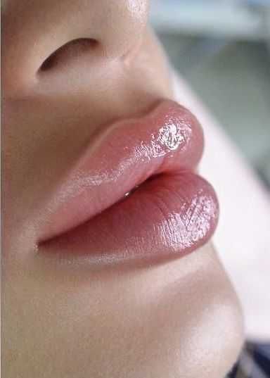 Увеличение Губ наполнение носогубки