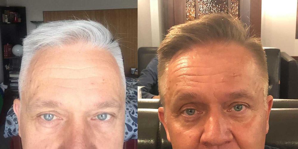 Tratament nat. pt. repigmentarea parului carunt, GR-7 Professional GR7