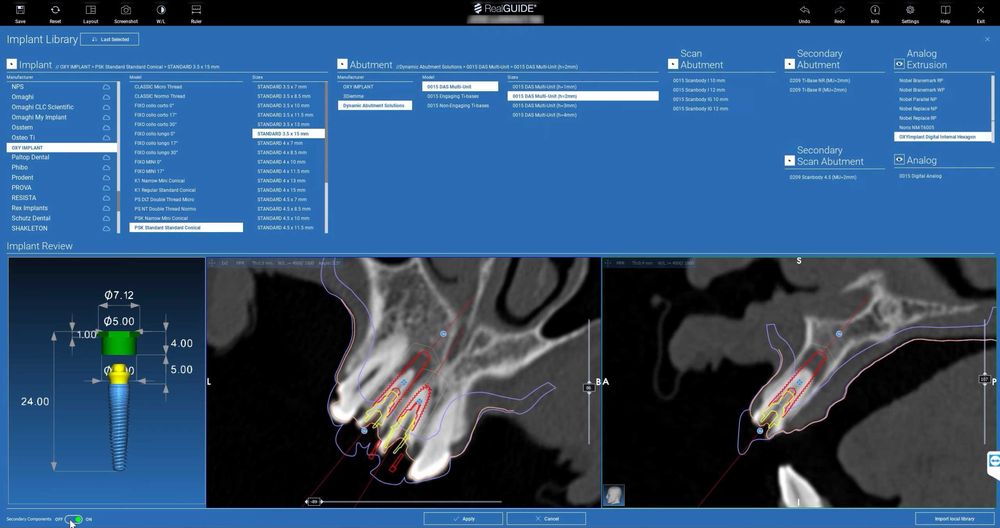 Realguide 5.4.2 + ImplantStation 5.3.2 + BlueSkyPlan + ImplantStudio