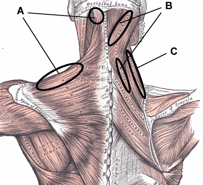 Массаж  ,спазм,триггеры