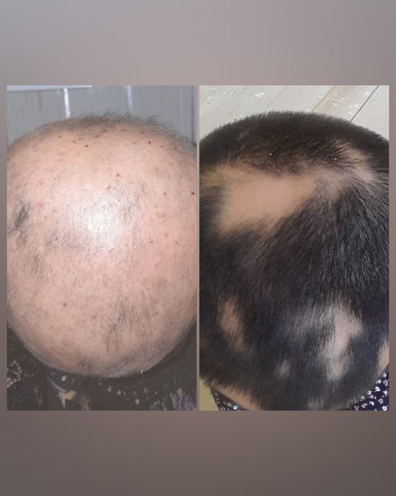 Пищевая добавка для укрепления волос