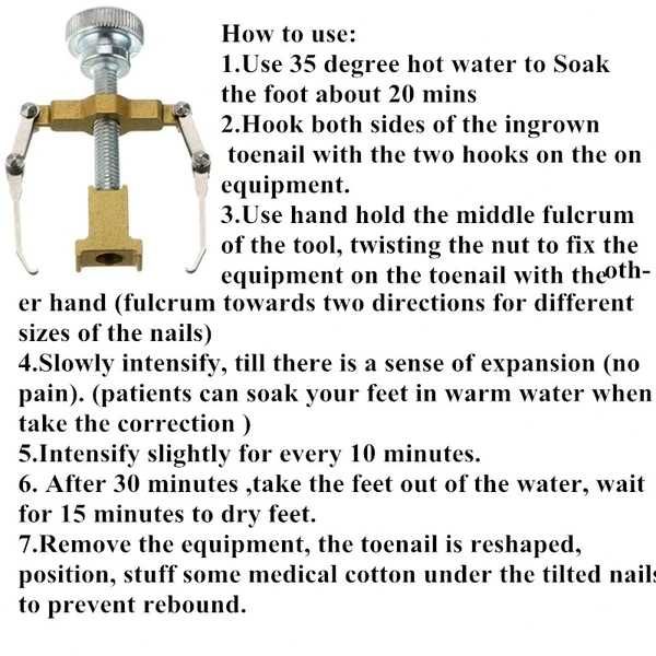 Фиксатор за врастнали нокти на крака
