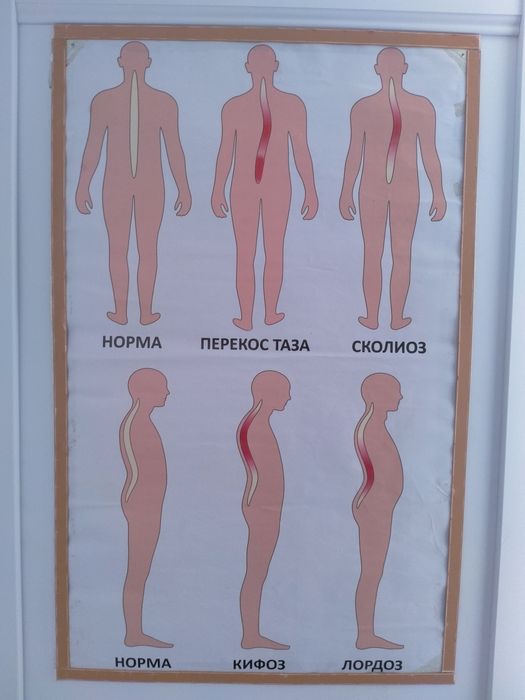 Массаж,лфк, восстановление.