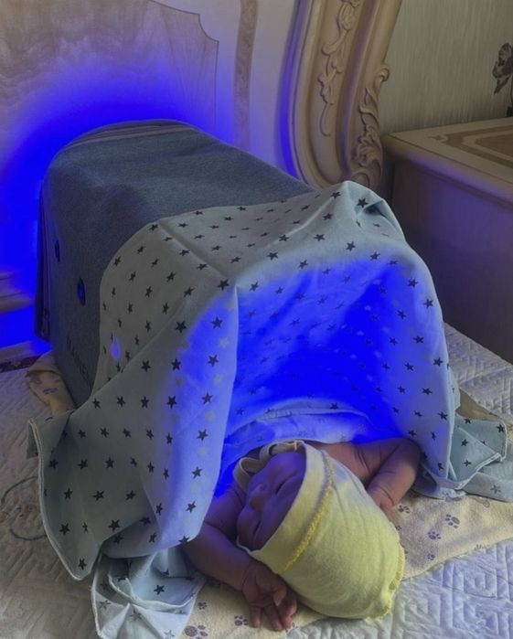 Лампа от желтушки