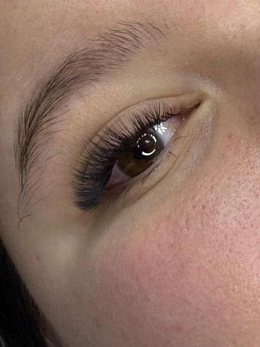 Aplicare extensii gene 1-3D