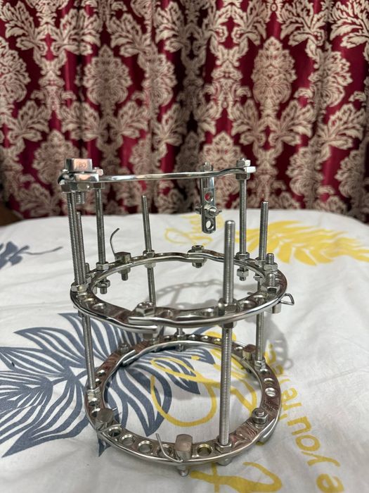 Аппарат илизарова пара, apparat ilizarova