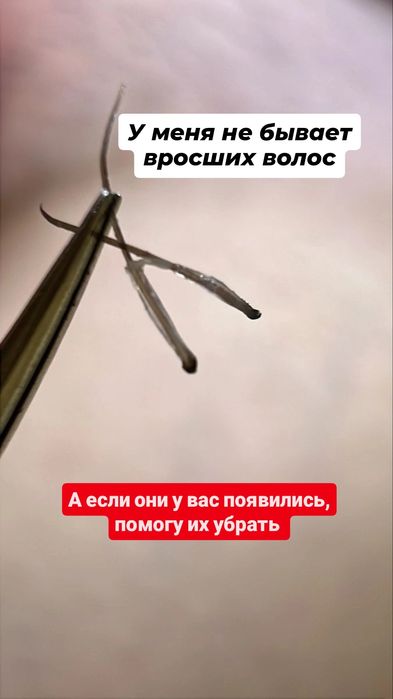 Шугаринг для мужчин