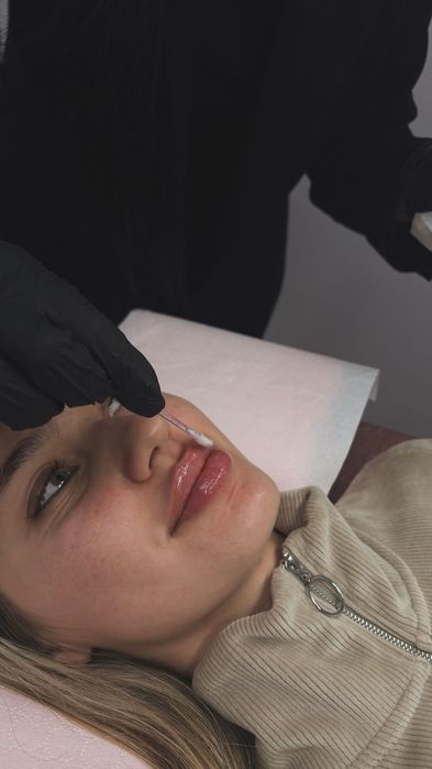 Buze perfecte cu Hyaluronpen