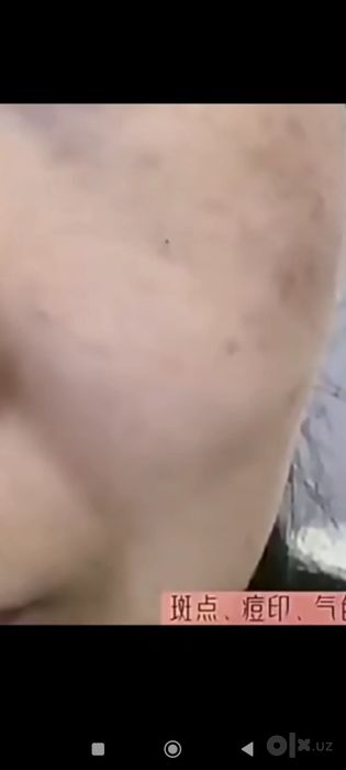 Сепкил догларга қарши сыворотка.