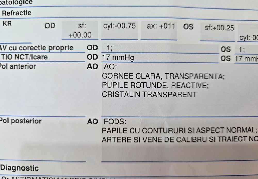 Ochelari de vedere pentru distanta Furla