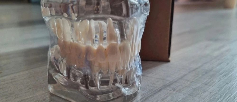 Model dentar multiple patologii