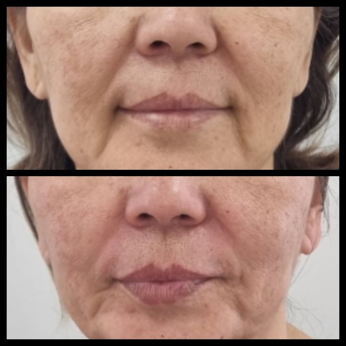 Массаж лица Караганда Юго-Восток