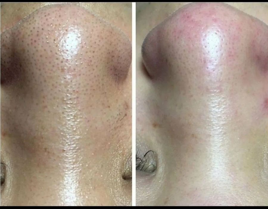 Косметолог эстетист, косметология хизматлари