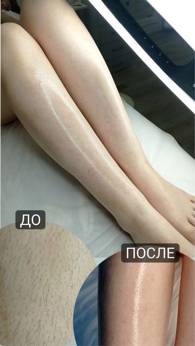 Шугаринг  женский