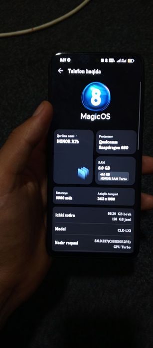 Honor x7b alo holatda hamma narsasi bor