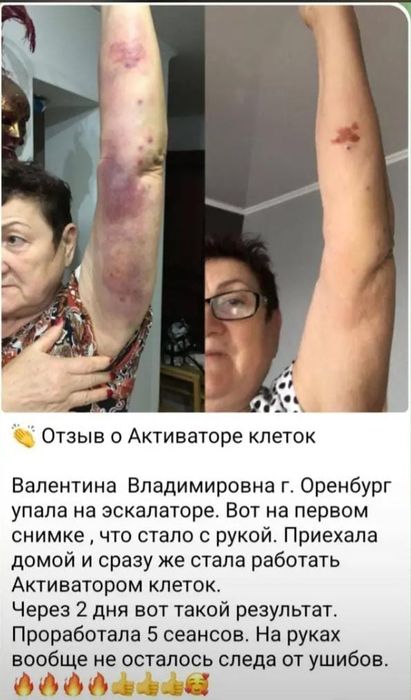 Продам аппарат Активатор клеток