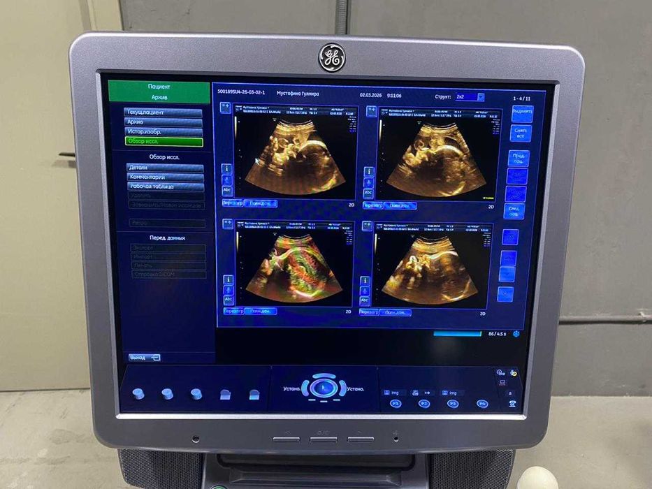 УЗИ аппарат экспертного класса GE Voluson S8