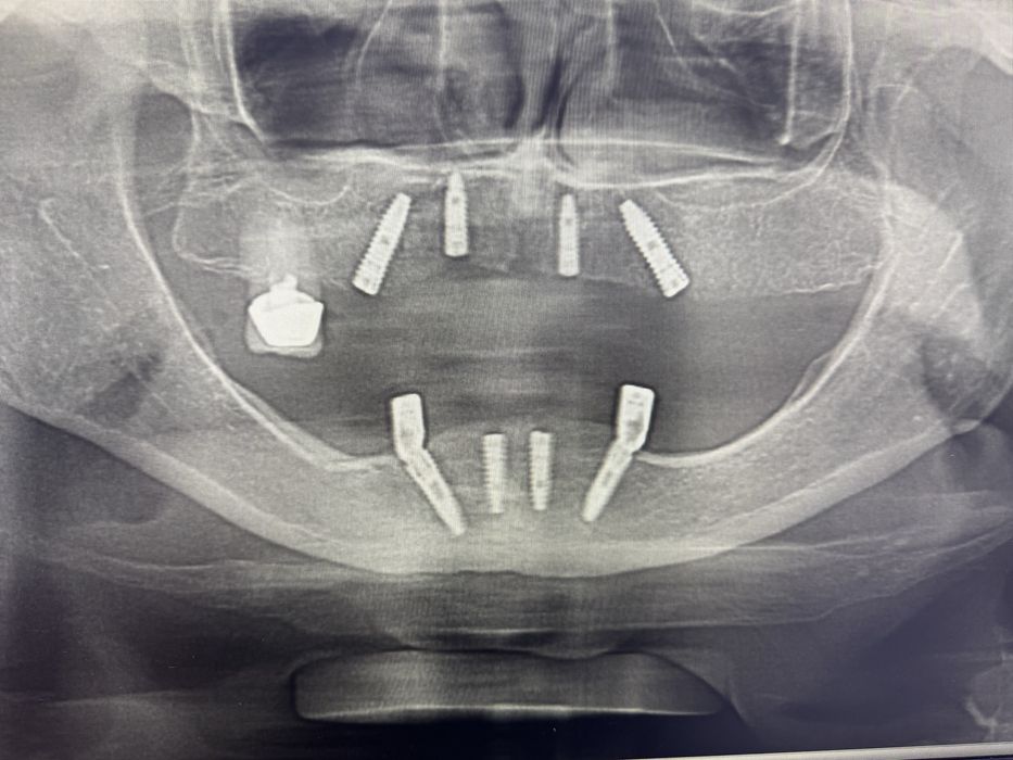 3D рентген апаррат