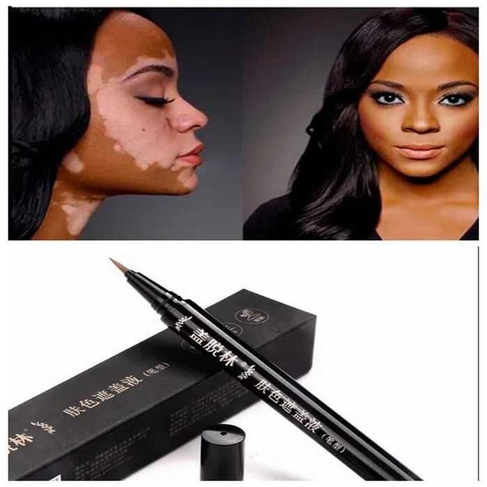 Oq dog'larga qarshi flamaster (витилиго фламастер)