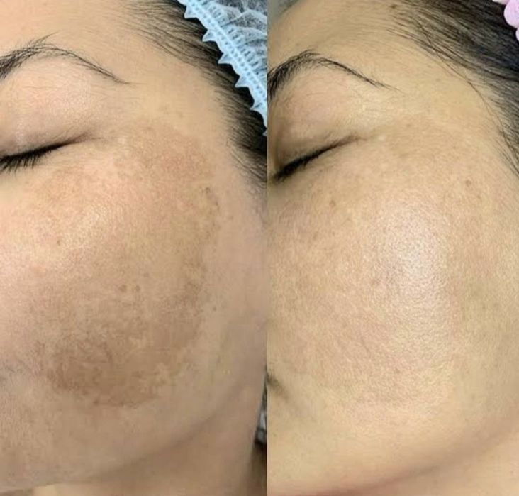 Косметолог Шахноза. Чиланзар квартал 9. Район ресторан.