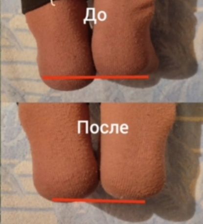 Костоправ массаж остеопат