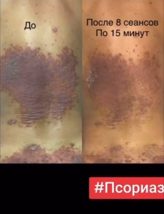 Продам аппарат Активатор клеток