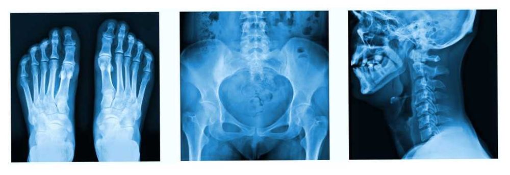 ВТОРО МНЕНИЕ ЗА КОМПЮТЪРНА ТОМОГРАФИЯ РЕНТГЕН СКЕНЕР ЯДРЕНО-МАГНИТЕН РЕЗОНАНС МАМОГРАФ.Разчитане на Образни Изследвания-КТ CT ЯМР MR Рентгенова снимка