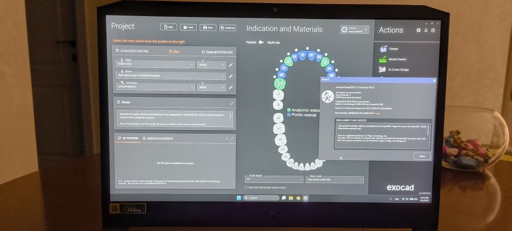 Laptop Gaming Exocad 3.3 Tehnică Dentară