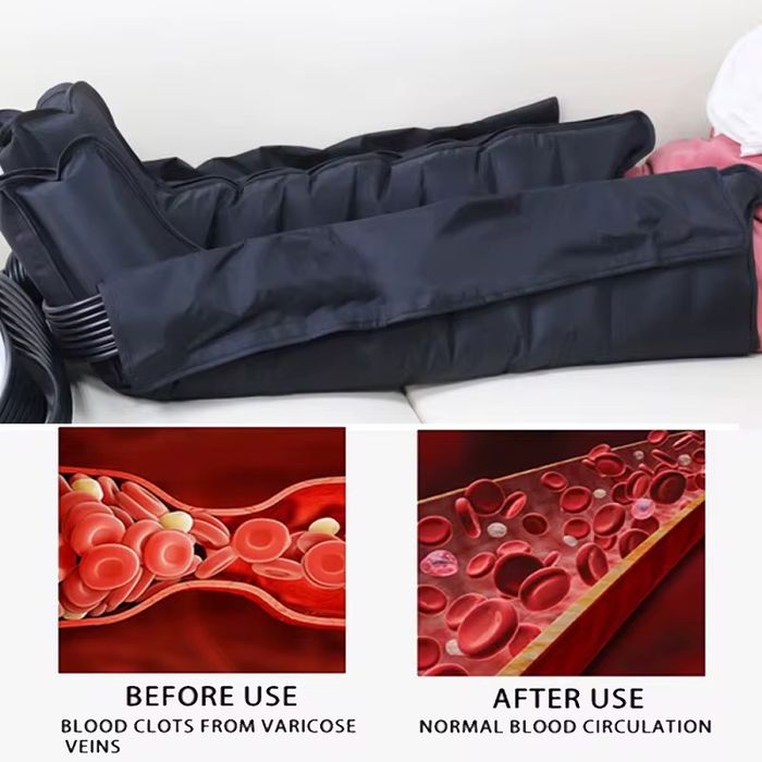 Drenaj limfatic, mastectomie limfedem