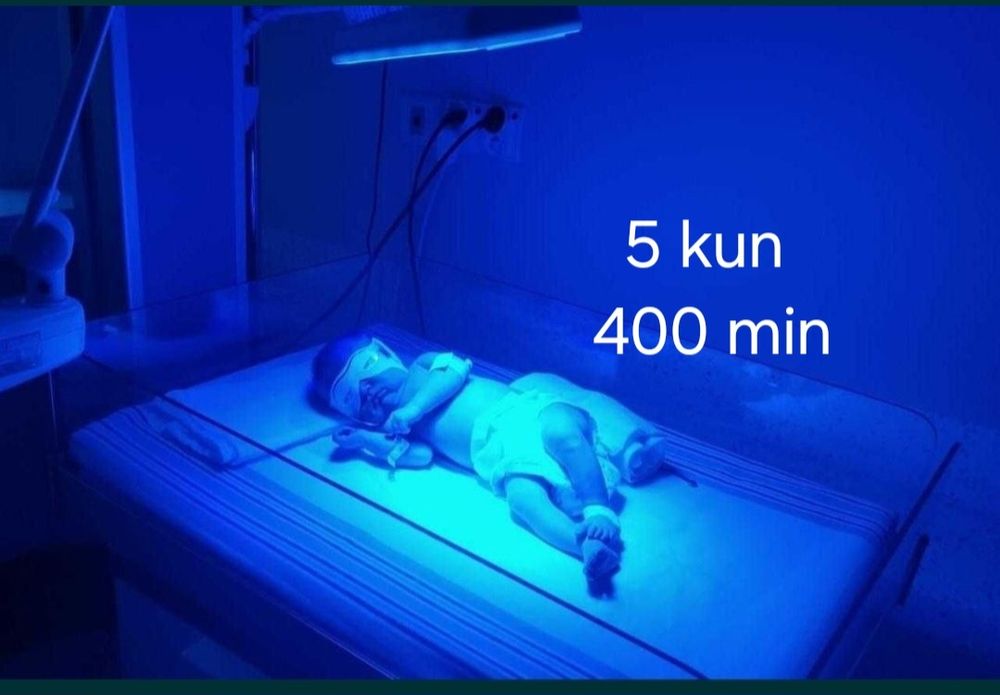 Фототерапия от желтухи 100 % гарантия