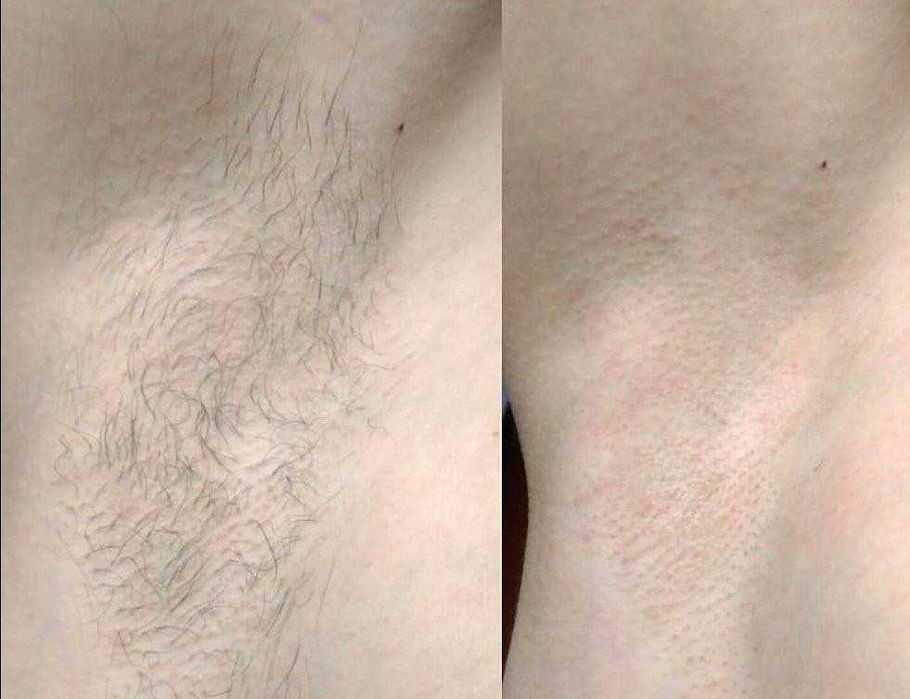 Шугаринг/воск для женщин