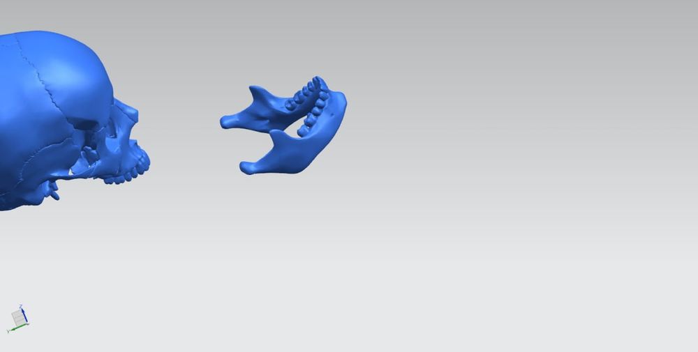 Bosh skeleti 3d printer da yasalgan