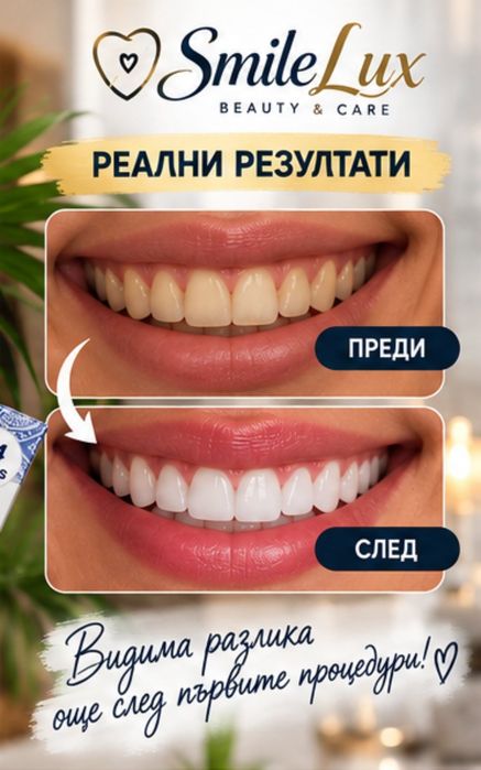 Eloura Premium Whitening Strips – избелващи ленти за зъби