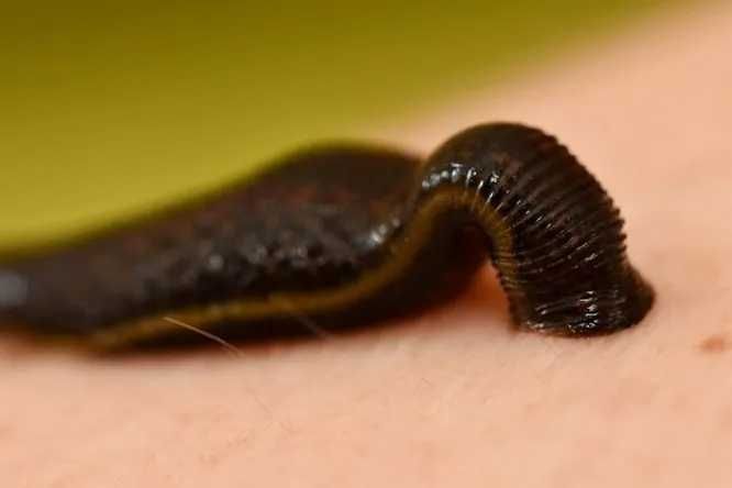 Лечение пиявками (Гирудотерапия) - 1500 тг., Турксибский район