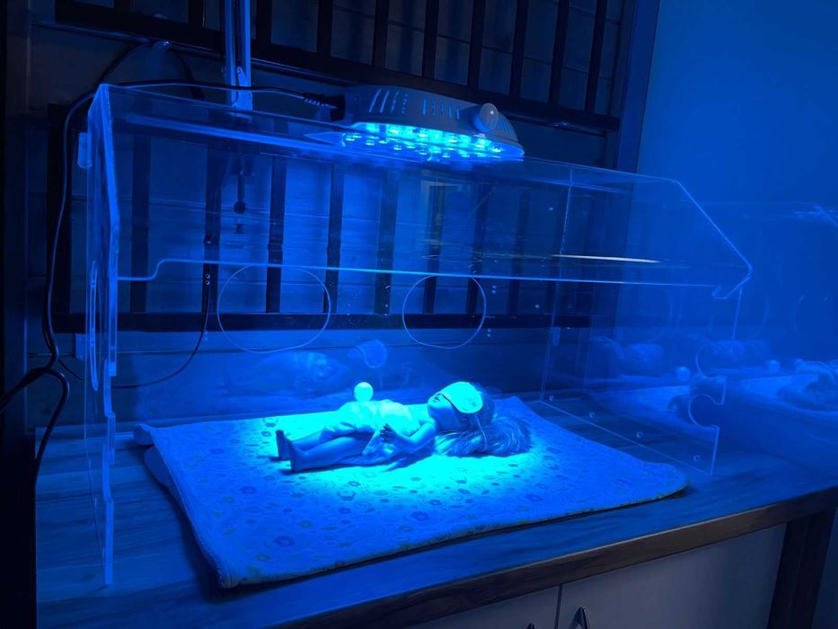 Лечите желтушку дома — аренда фотолампы с доставкой