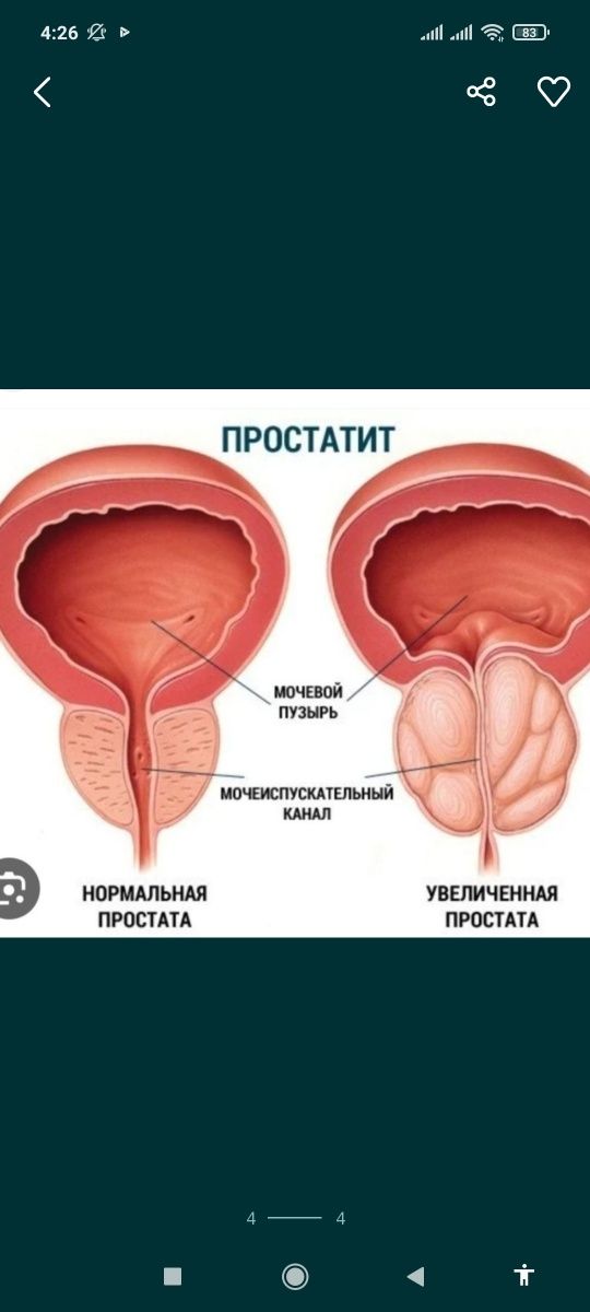 Массаж простаты в г. Белгород