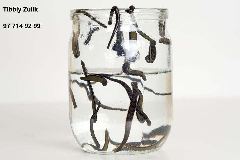 Zuluk sotiladi, Продаю пиявки