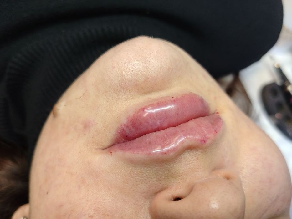 Косметолог эстетист, косметология хизматлари