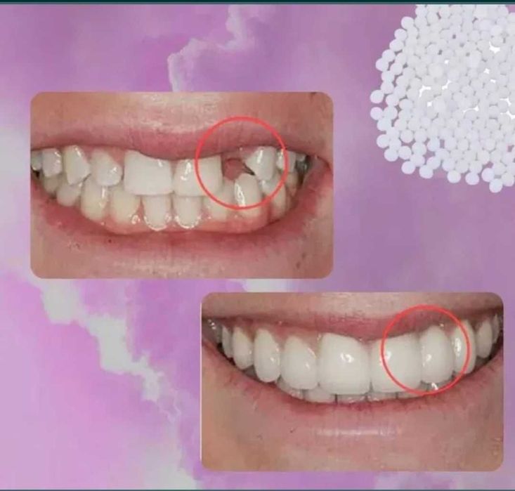 Пластик самозатвердевающий для ремонта зубов.