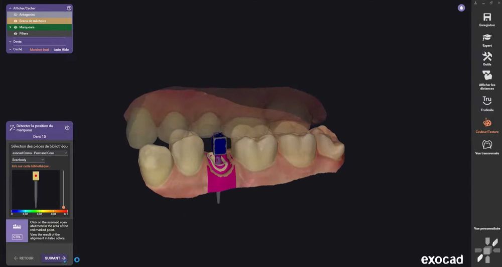 EXOCAD 3.3 Chemnitz + PartialCAD ​​3.3 + ExoPlan 3.1 + B4D iBar