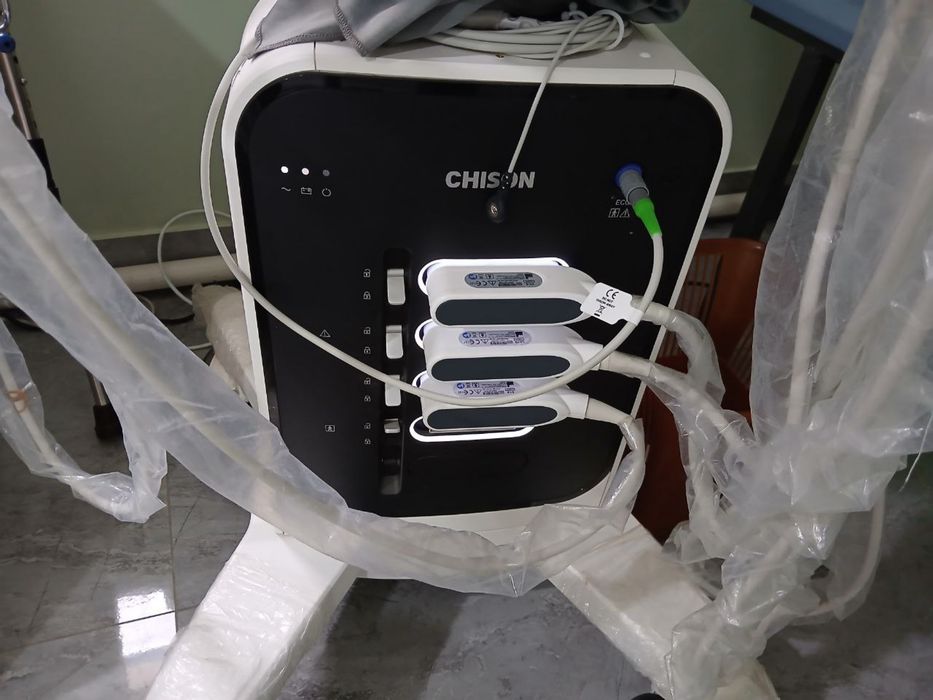 Uzi aparat chison Xbit 80 sotiladi 2025 may oyida ishlab chiqarilgan