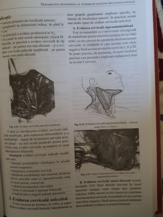 Chirurgie maxilo-faciala
