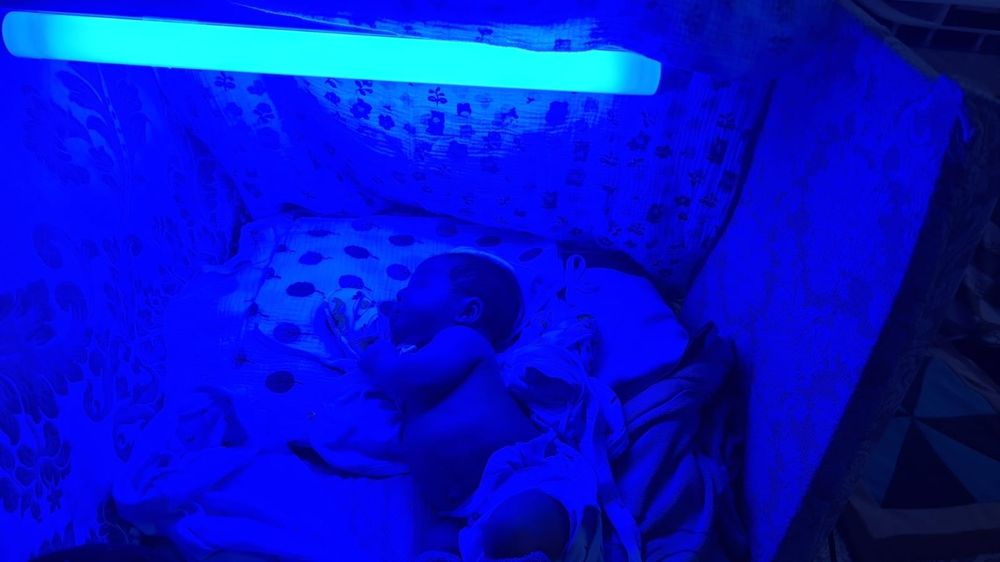 ФОТОЛампА. ЖелтушкА.