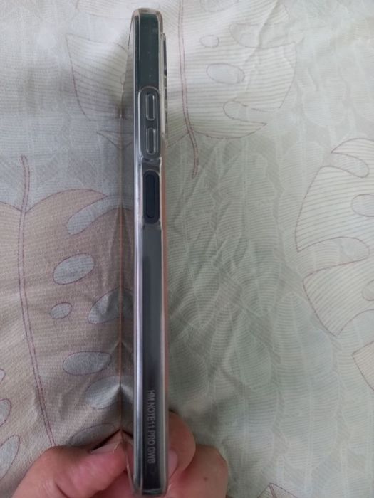Xiomi Redmi not 11 pro