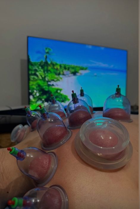 Masaj Terapeutic, Terapie Manuală & Ventuze | 4 ani experiență