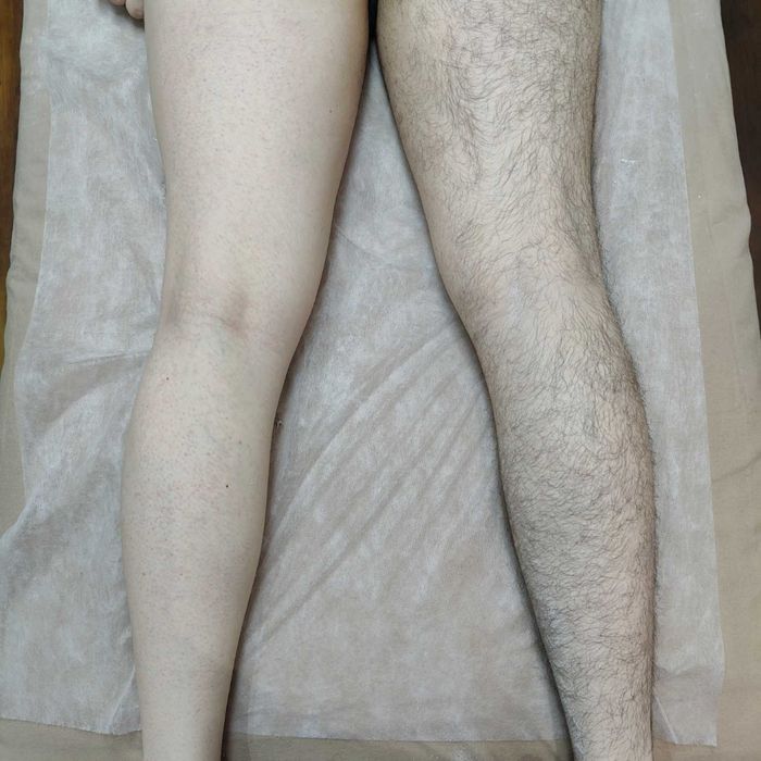 Sugaring , epilare cu zahar, depilare pentru femei si barbati