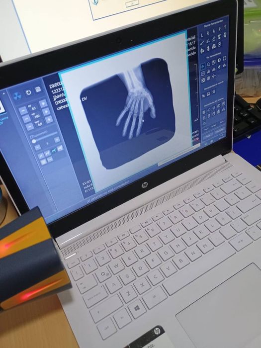 Портативный рентген аппарат X-Ray