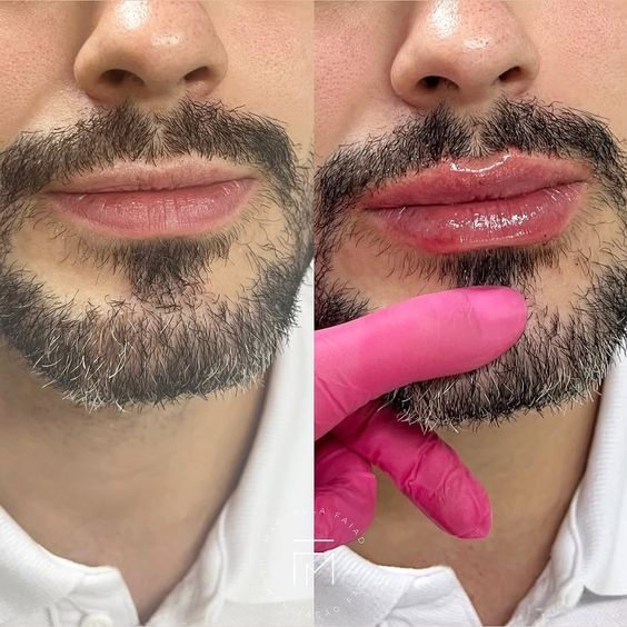 Эстетика красота