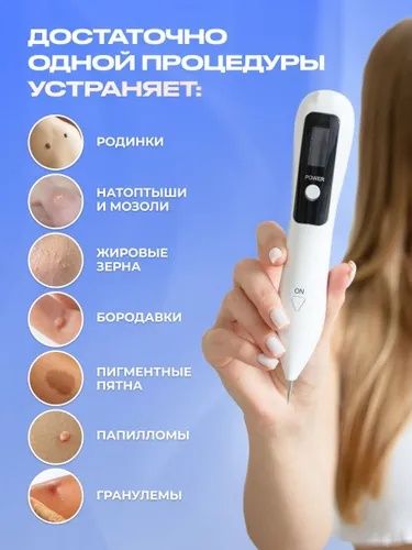 Косметический аппарат для удаления папиллом и бородавок. Коагулятор