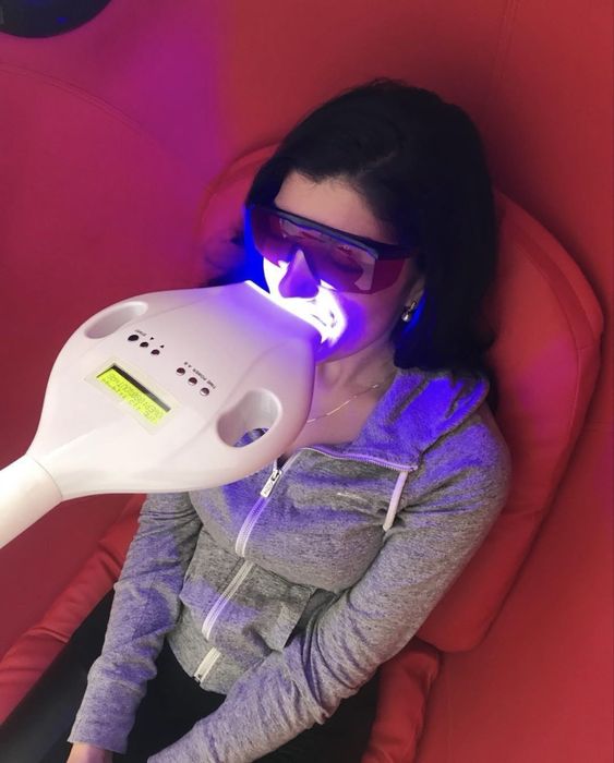 Машина за избелване на зъби